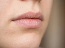 Алкоголь и слизистые оболочки: что происходит с губами при запое и когда без врача не обойтись