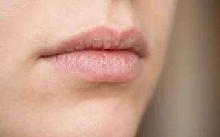 Алкоголь и слизистые оболочки: что происходит с губами при запое и когда без врача не обойтись